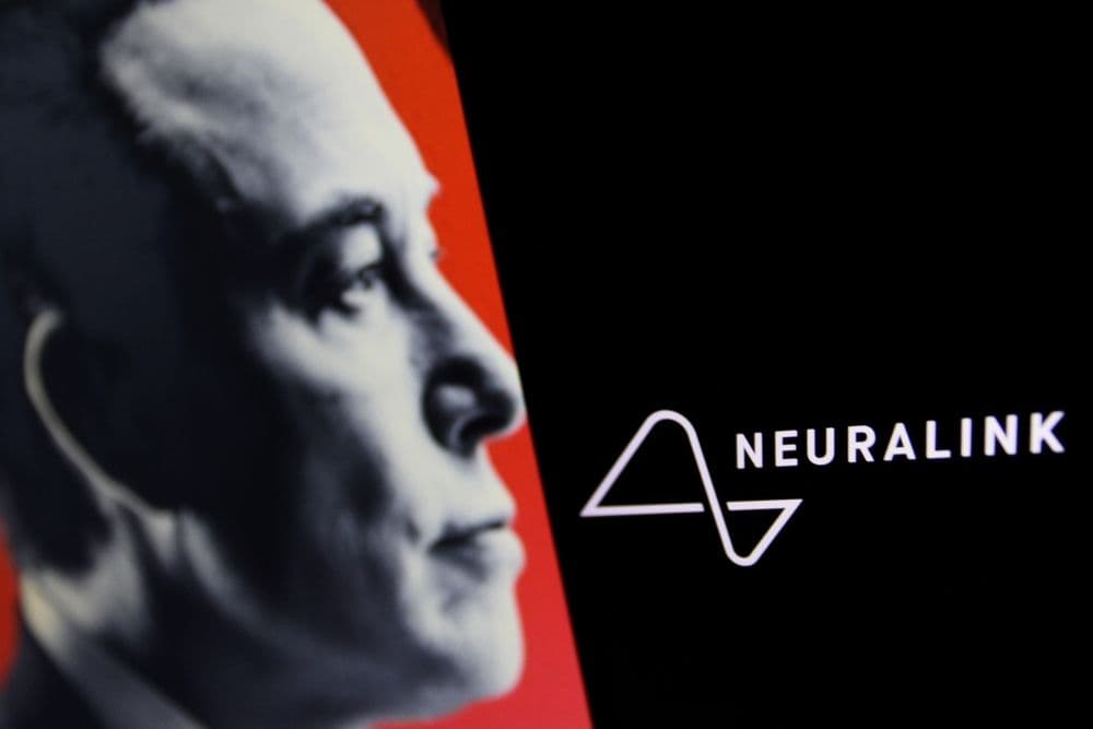 Elon Musk’s Neuralink Launches Human Brain Chip Trials